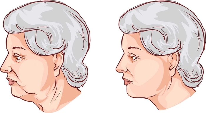 Самодельная золотая маска обменяет ваши 50 лет на 35