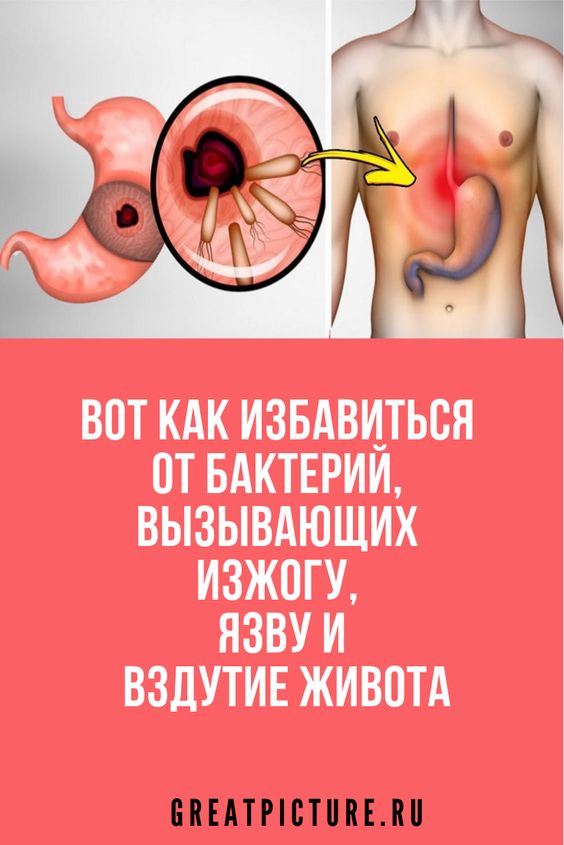 Вот как избавиться от бактерий, вызывающих изжогу, язву и вздутие живота