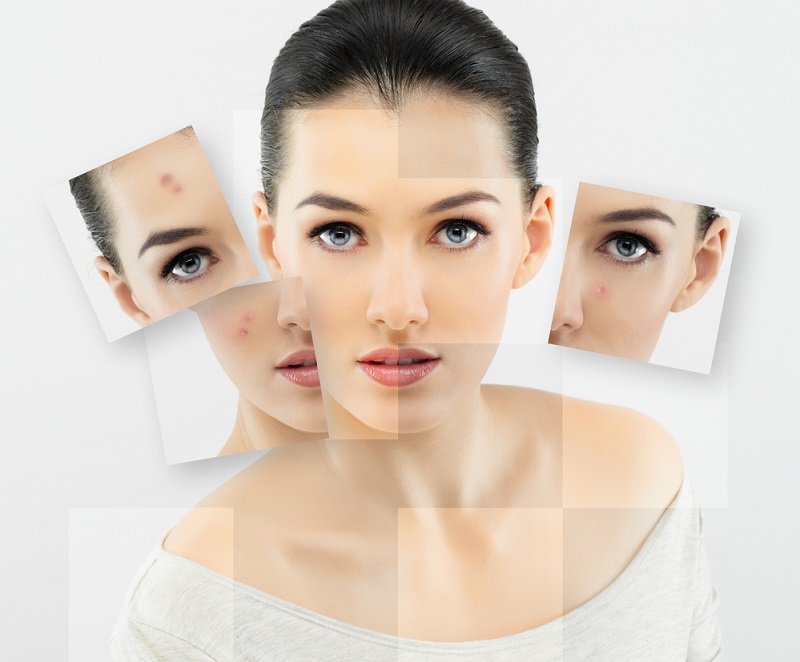 Гепариновая мазь для лица: свежее и подтянутое лицо уже после нескольких дней применения. Чтобы омолодить кожу лица на 10–15 лет.