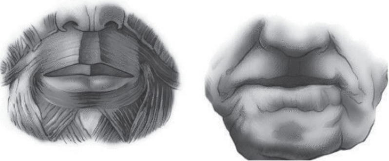 Круговая мышца рта: как сделать лицо подтянутым и эластичным
