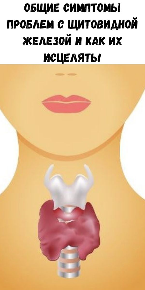 Проблемы с щитовидной симптомы у мужчин. Проблемы стщитовидной железой. Щитовидная железа симптомы. Проблемы с щитовидной железой у женщин.