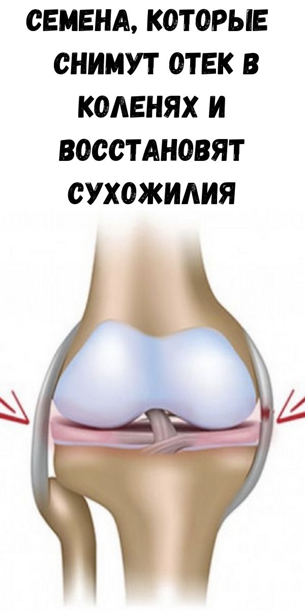 Боковая связка коленного сустава лечение. Разрыв наружной боковой связки коленного. Внешняя боковая связка колена. Наружная боковая связка коленного сустава. Боковые связки коленного сустава.