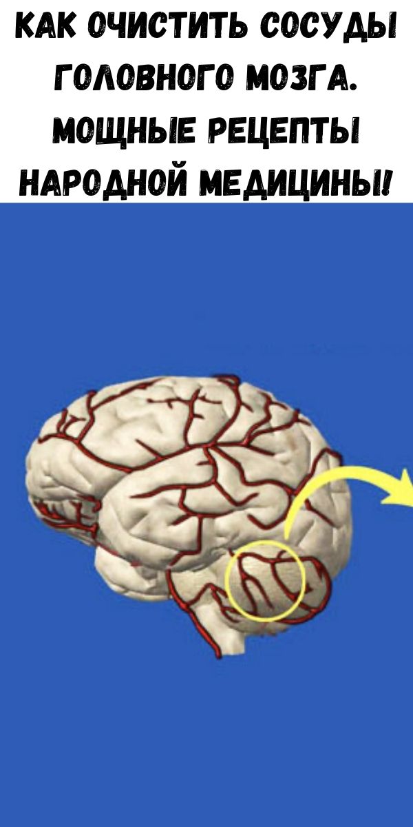 Сильные мозги. Очищение сосудов головного мозга. Рецепты очищения сосудов головного мозга. Болезнь сосудов головного мозга.