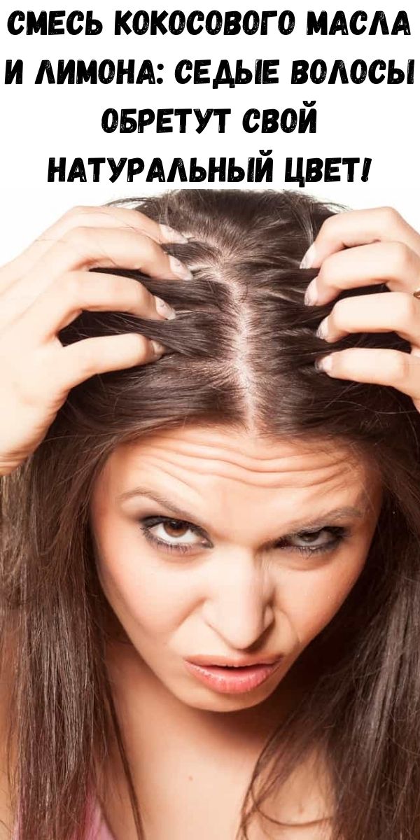 Как остановить выпадение волос в домашних. Выпадение волос у женщин. Предотвращает выпадение волос. Остановить выпадение волос.