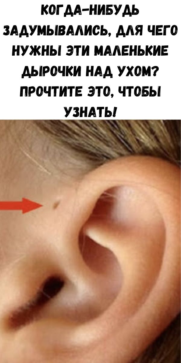 Когда-нибудь задумывались, для чего нужны эти маленькие дырочки над ухом? Прочтите это, чтобы узнать!