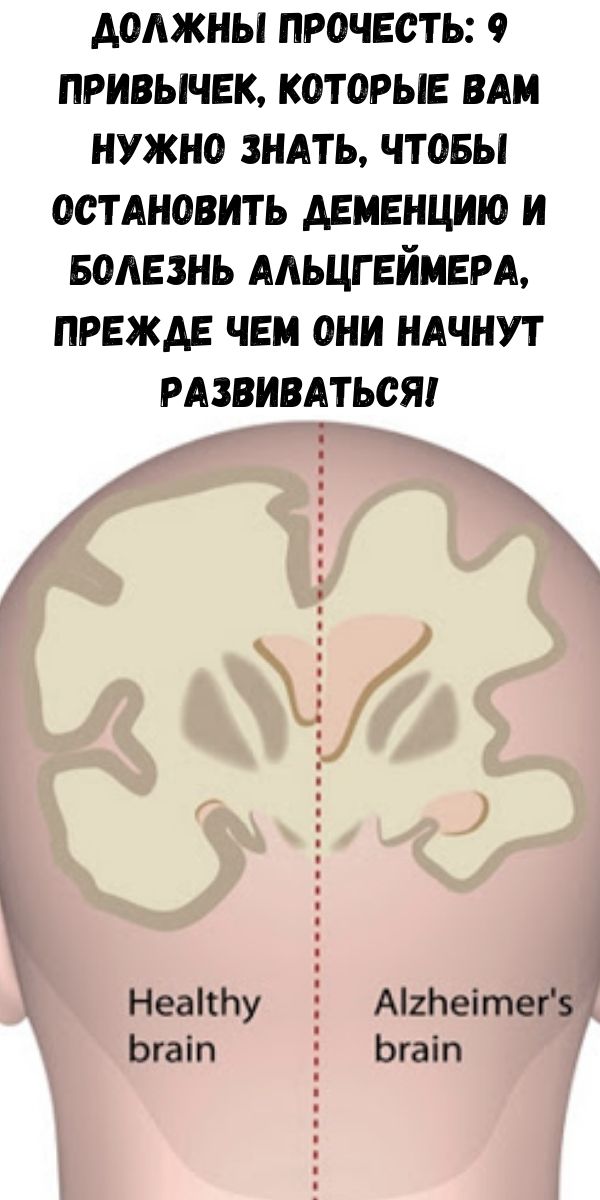 Тест альцгеймера картинки лица. Японский тест на деменцию. Тест для деменции мозга. Болезнь Альцгеймера. Тесты на деменцию в картинках.