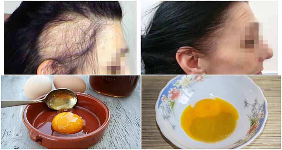 Как отрастить волосы при помощи яйца