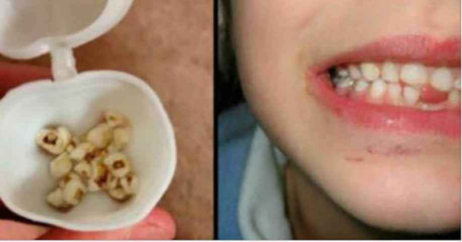 Узнайте, почему вы должны сохранить детские молочные зубы!