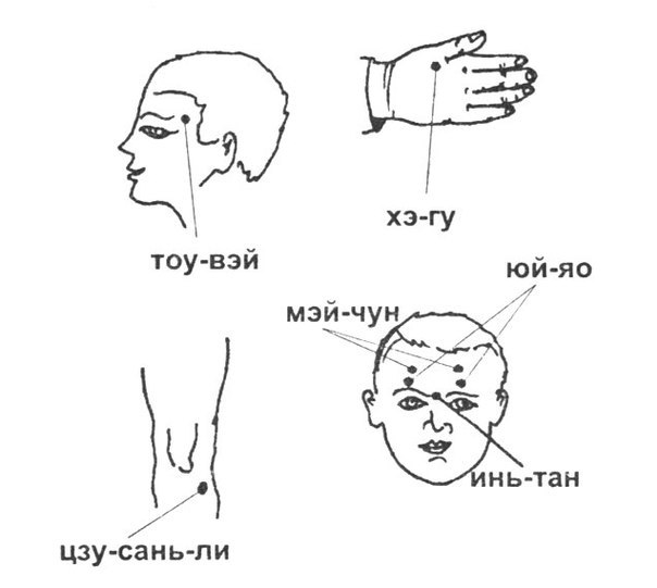 Точки хиджамы схема для мужчин