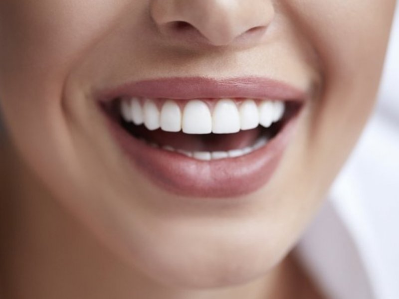 8 доступных шагов для отбеливания зубов